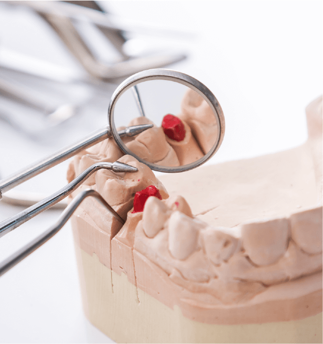 Oglindă plană nr.5set 12 buc M+W Dental